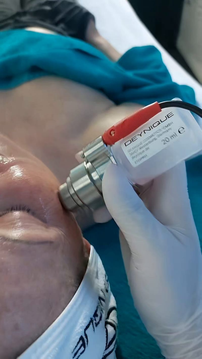 Intraskin Infusion in der Kabine: das DEYNIQUE Intraskin-Handstück mit Wirkstoff-Ampulle
